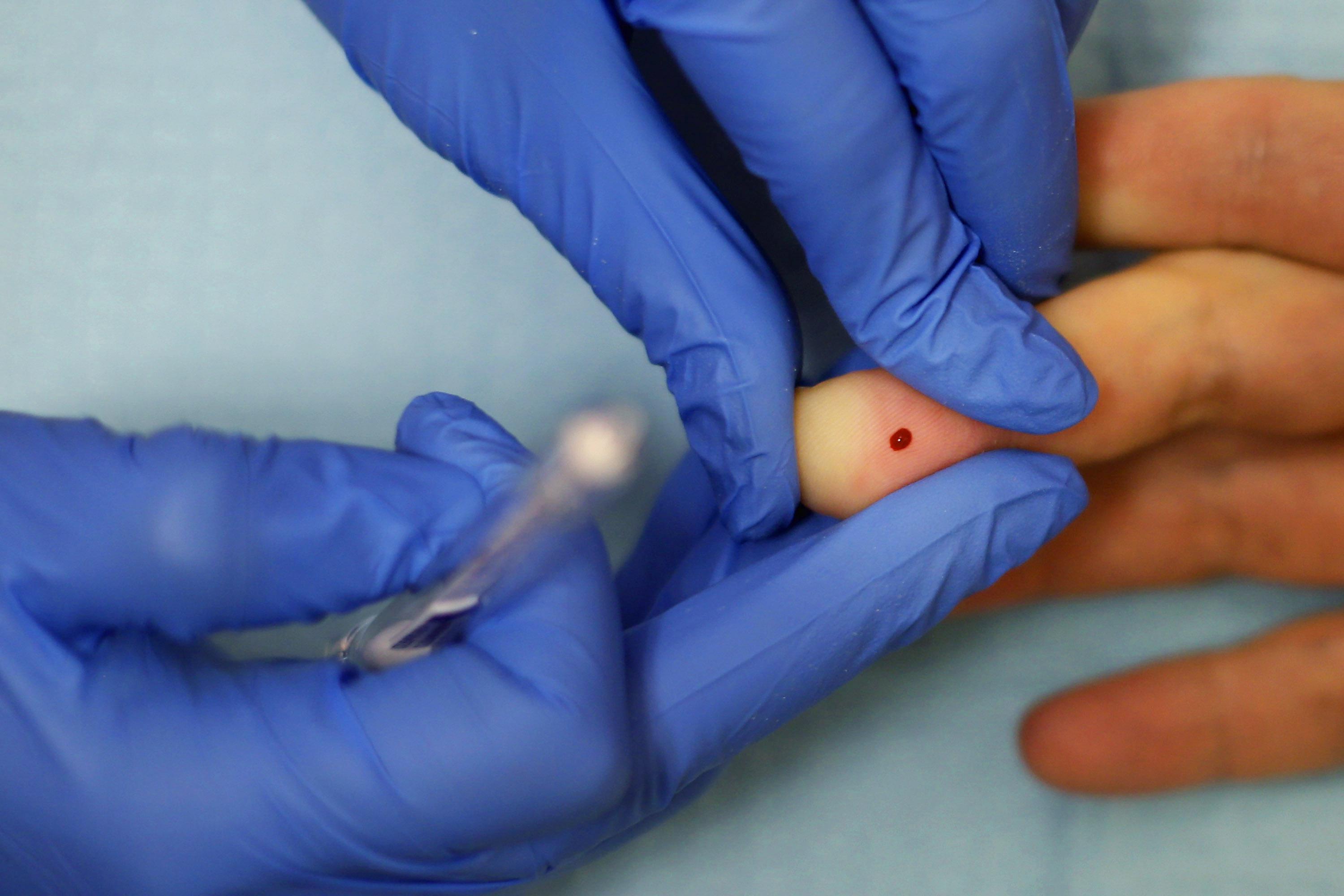 Nat'l Gay Men's HIV/AIDS Awareness Day Marked With Expanded HIV/AIDS Testing