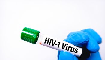 Blood sample for HIV-1 virus test, HIV screening test.